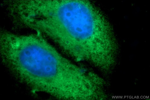 [25539-1-AP-20UL] PGBD1 Polyclonal antibody