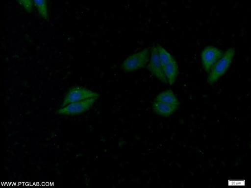 [25540-1-AP-20UL] WDR92 Polyclonal antibody