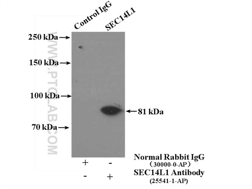 [25541-1-AP-20UL] SEC14L1 Polyclonal antibody