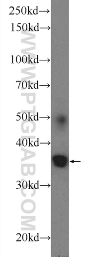 [25548-1-AP-20UL] ATRAID Polyclonal antibody