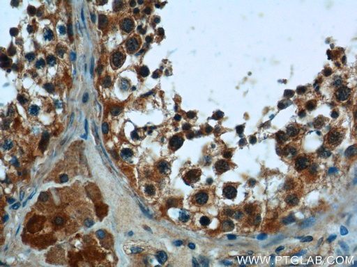 [25559-1-AP-20UL] PNLDC1 Polyclonal antibody
