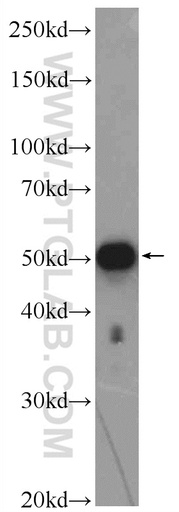 [25573-1-AP-20UL] ZNF689 Polyclonal antibody