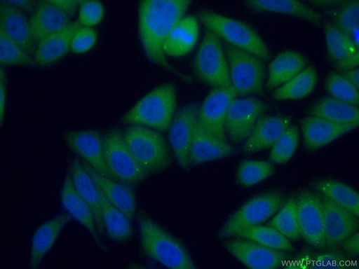[25576-1-AP-150UL] C2orf79/PTRHD1 Polyclonal antibody