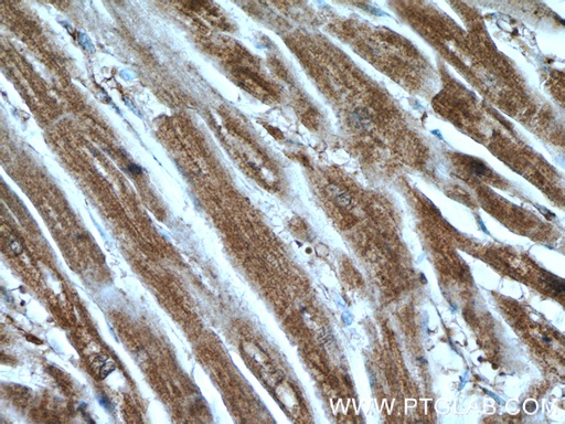 [25577-1-AP-150UL] KBTBD10 Polyclonal antibody