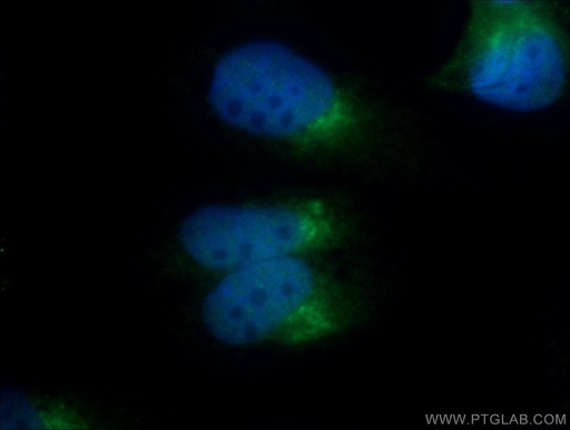 [25583-1-AP-150UL] C13orf30 Polyclonal antibody