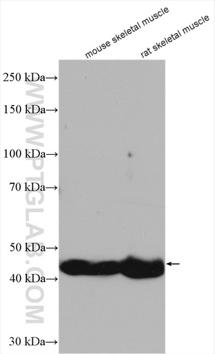 [25584-1-AP-20UL] LRRC52 Polyclonal antibody