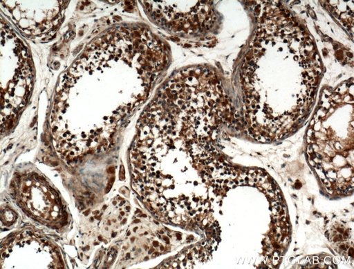 [25587-1-AP-150UL] ZMYND12 Polyclonal antibody