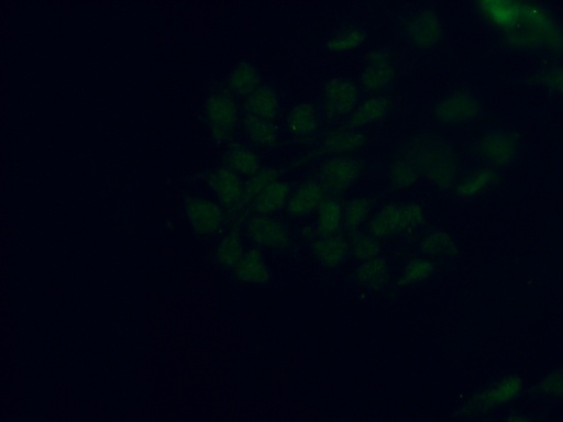 [25589-1-AP-20UL] SMCHD1 Polyclonal antibody