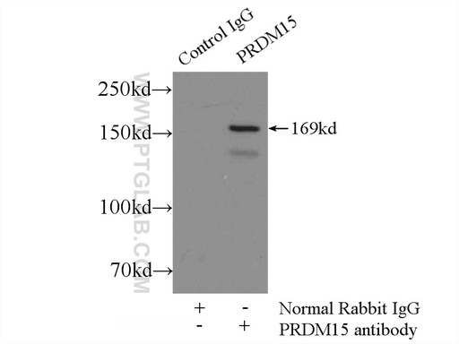 [25590-1-AP-150UL] PRDM15 Polyclonal antibody