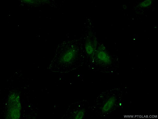 [25592-1-AP-20UL] ZNF549 Polyclonal antibody