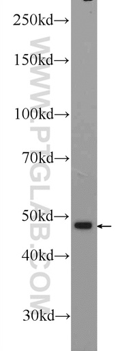 [25593-1-AP-20UL] ZNF323 Polyclonal antibody