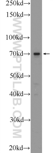 [25595-1-AP-20UL] TM9SF4 Polyclonal antibody
