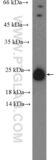 [25596-1-AP-20UL] C6orf108 Polyclonal antibody