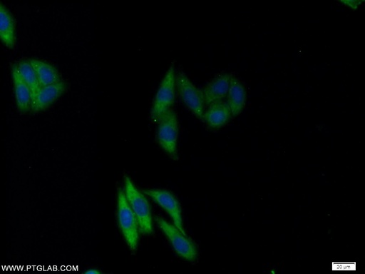 [25598-1-AP-150UL] NFU1 Polyclonal antibody