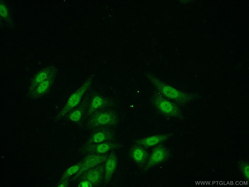 [25599-1-AP-20UL] ZNF101 Polyclonal antibody