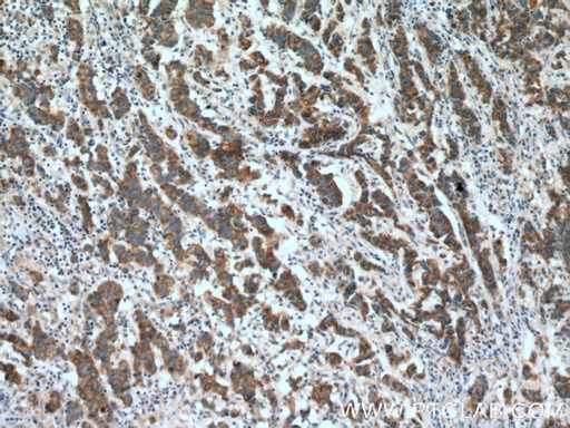 [25600-1-AP-150UL] ZNF645 Polyclonal antibody