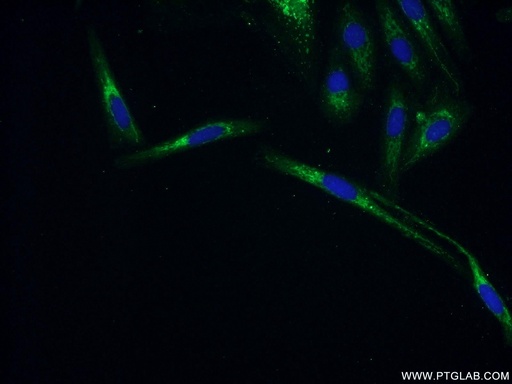 [25601-1-AP-20UL] ZNF251 Polyclonal antibody