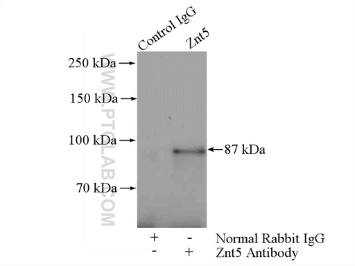 [25604-1-AP-150UL] Znt5 Polyclonal antibody