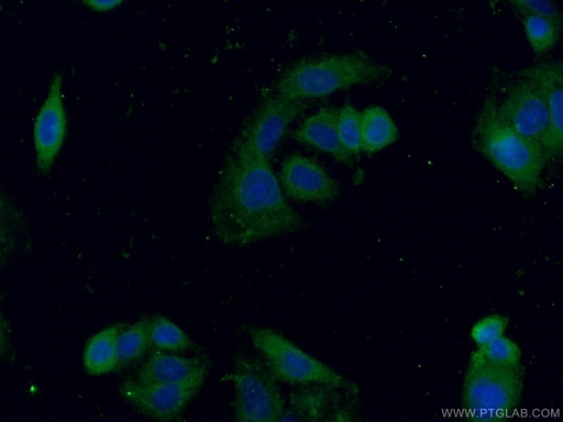 [25608-1-AP-150UL] EPHX3 Polyclonal antibody