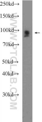 [25609-1-AP-20UL] FSD2 Polyclonal antibody