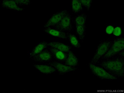 [25614-1-AP-150UL] P27; KIP1 Polyclonal antibody