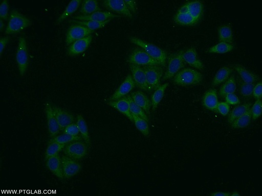 [25616-1-AP-20UL] ASB13 Polyclonal antibody
