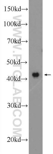 [25618-1-AP-150UL] OMCG1 Polyclonal antibody