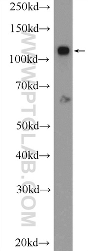 [25624-1-AP-20UL] ZC3H7B Polyclonal antibody