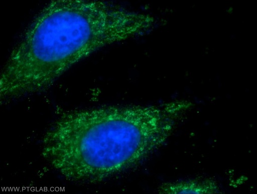 [25625-1-AP-20UL] CHCHD3 Polyclonal antibody