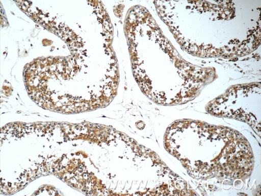 [25626-1-AP-150UL] SLC52A3 Polyclonal antibody