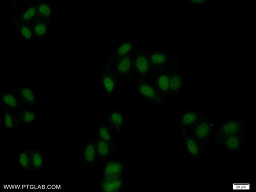[25631-1-AP-20UL] ZBTB25 Polyclonal antibody