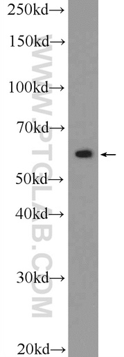 [25633-1-AP-150UL] ZBTB22 Polyclonal antibody