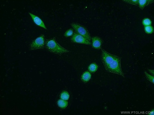 [25643-1-AP-150UL] VNN2 Polyclonal antibody