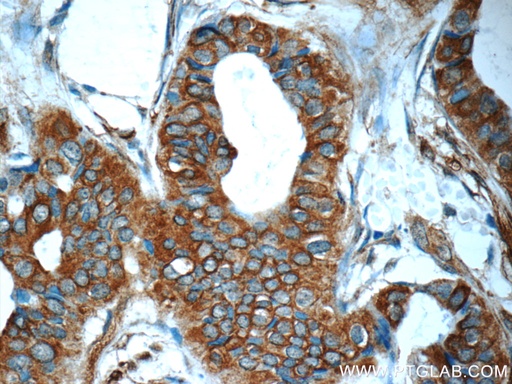 [25645-1-AP-20UL] Mammaglobin A Polyclonal antibody