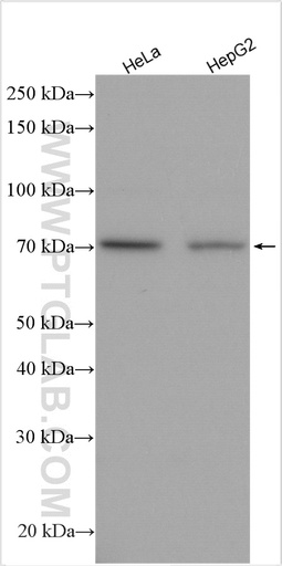[25649-1-AP-20UL] TNFAIP2 Polyclonal antibody