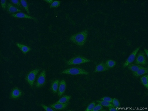 [25650-1-AP-150UL] C19orf36 Polyclonal antibody