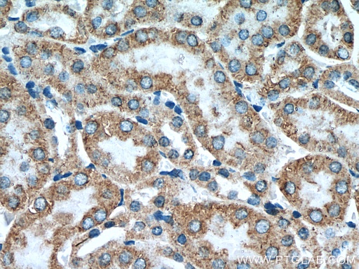 [25653-1-AP-20UL] KIAA1279 Polyclonal antibody