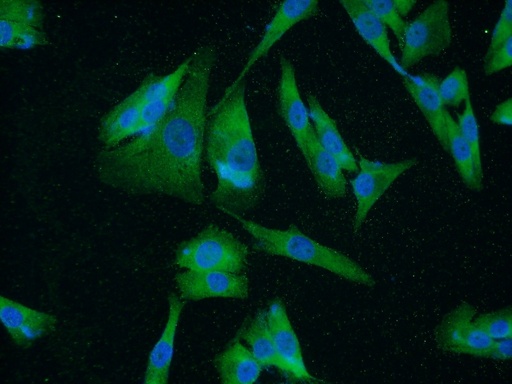 [25654-1-AP-150UL] UACA Polyclonal antibody