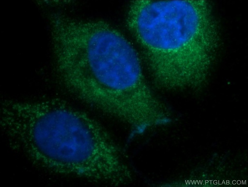 [25658-1-AP-150UL] DENND1A Polyclonal antibody