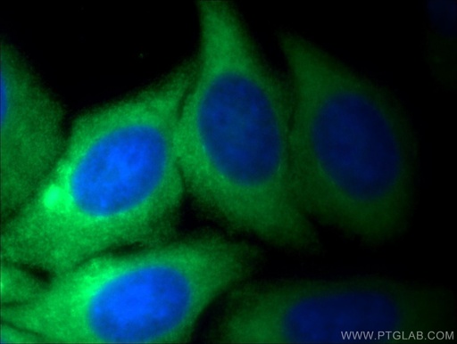 [25659-1-AP-150UL] PKM Polyclonal antibody