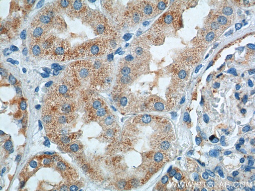 [25660-1-AP-150UL] TTC17 Polyclonal antibody