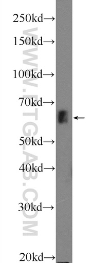 [25669-1-AP-20UL] ZNF668 Polyclonal antibody