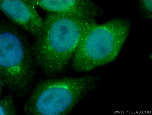 [25674-1-AP-20UL] GGA1 Polyclonal antibody