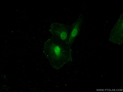 [25679-1-AP-20UL] GATAD2B Polyclonal antibody