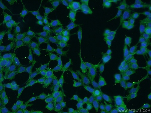 [25681-1-AP-20UL] SPTBN1 Polyclonal antibody