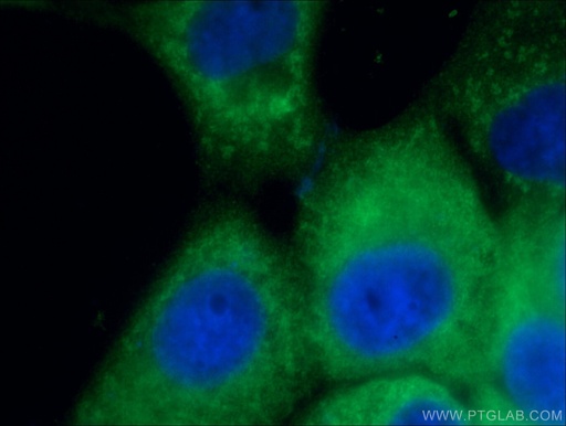 [25682-1-AP-150UL] CD63 Polyclonal antibody