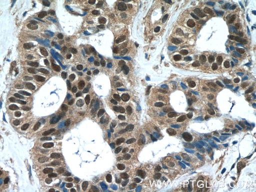 [25683-1-AP-150UL] WDR38 Polyclonal antibody
