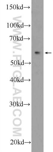 [25685-1-AP-20UL] RNFT2 Polyclonal antibody