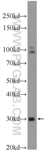 [25687-1-AP-150UL] TXNDC11 Polyclonal antibody