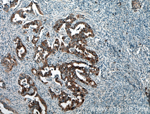 [25692-1-AP-150UL] BAIAP2L1 Polyclonal antibody